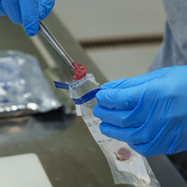 Person placing lymph node in whirlpack