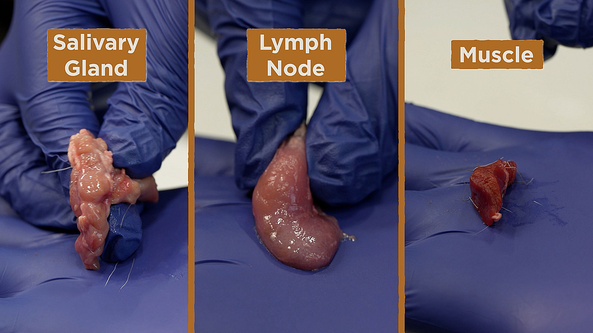 Lymph node (left) salivary gland (middle), muscle tissue (right)