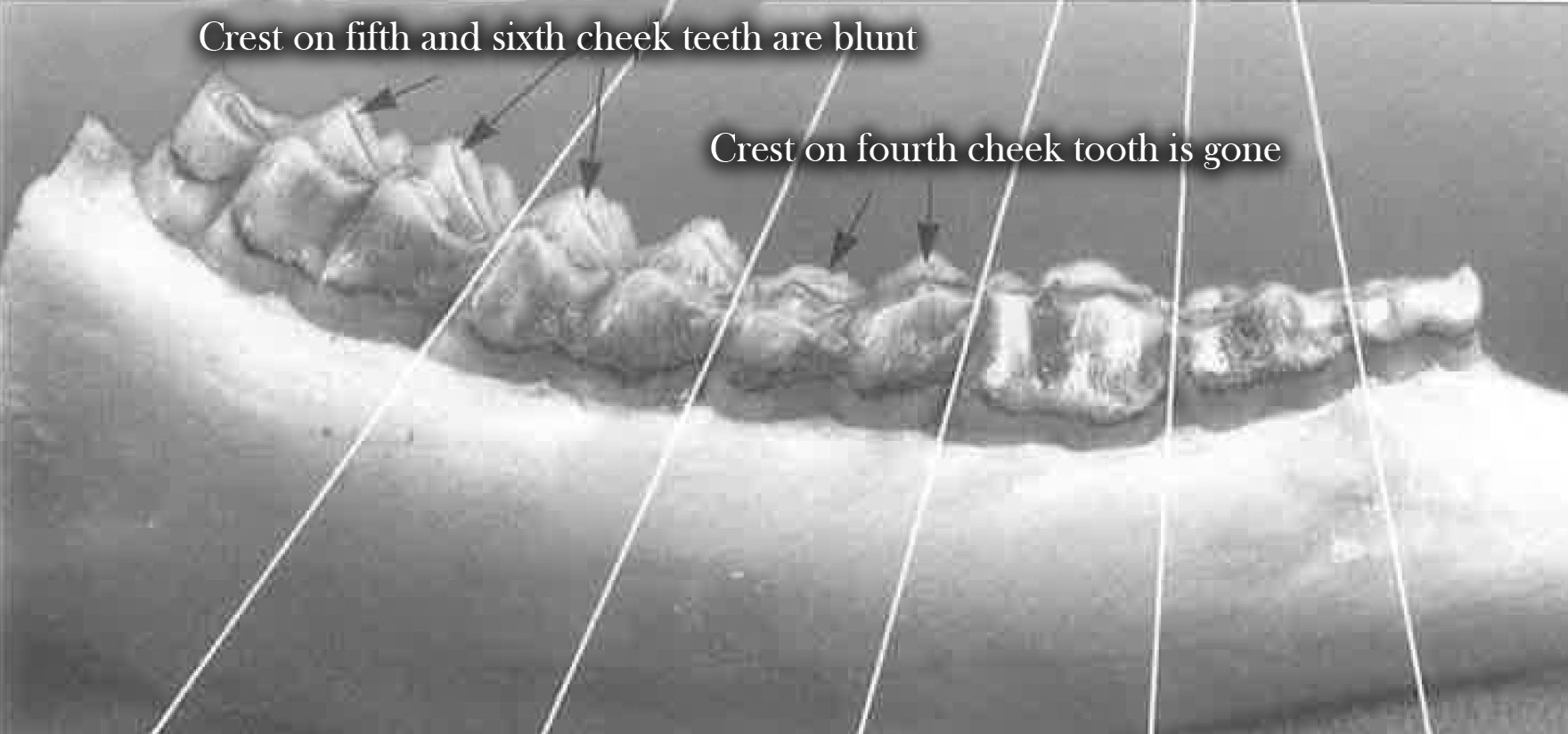 Teeth at 4.5 years of age