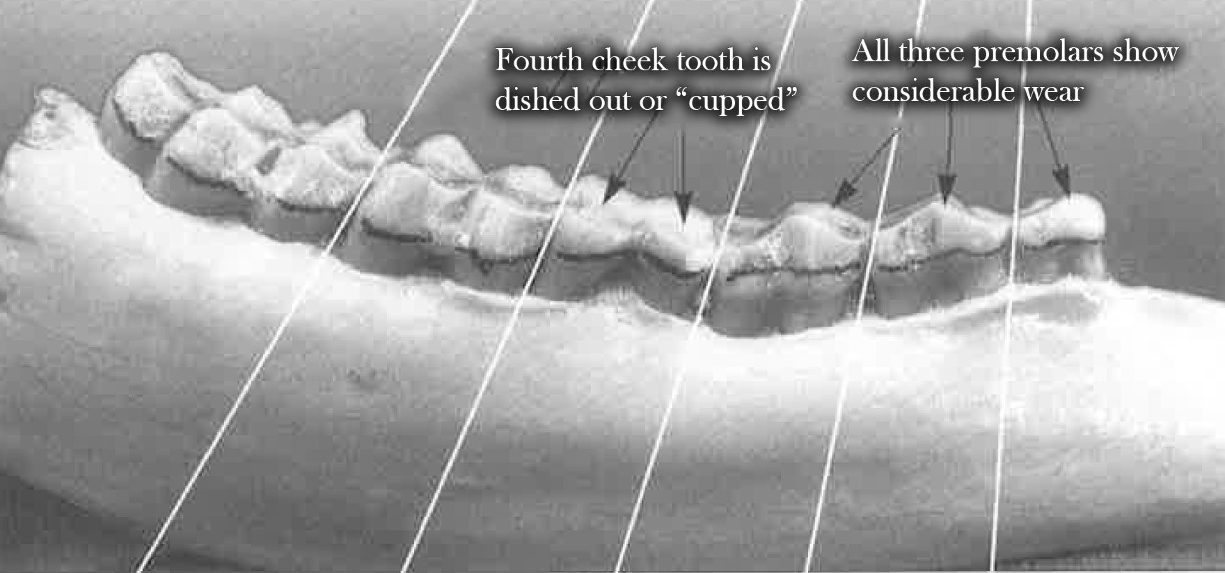 Teeth at 5.5 years of age