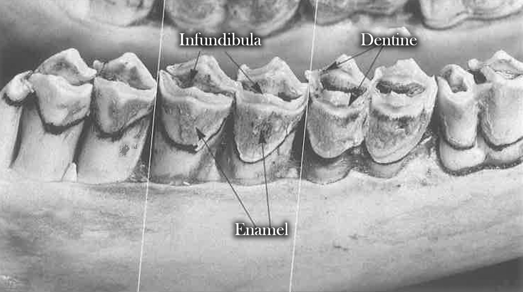 Tooth parts