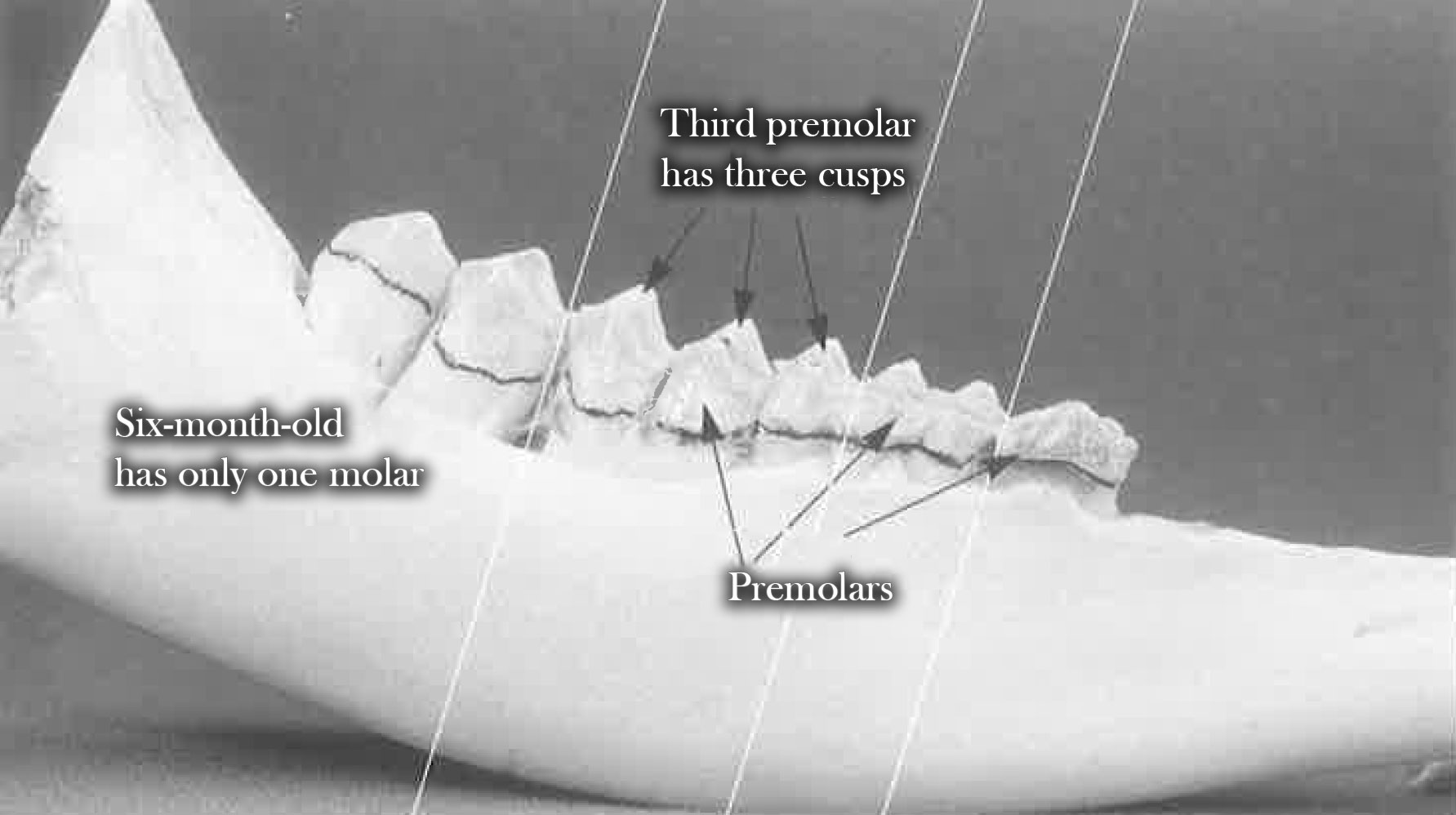 Teeth at 6 months of age