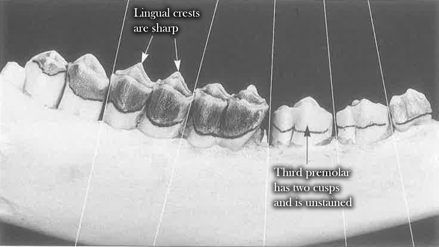 Teeth at 2.5 years of age