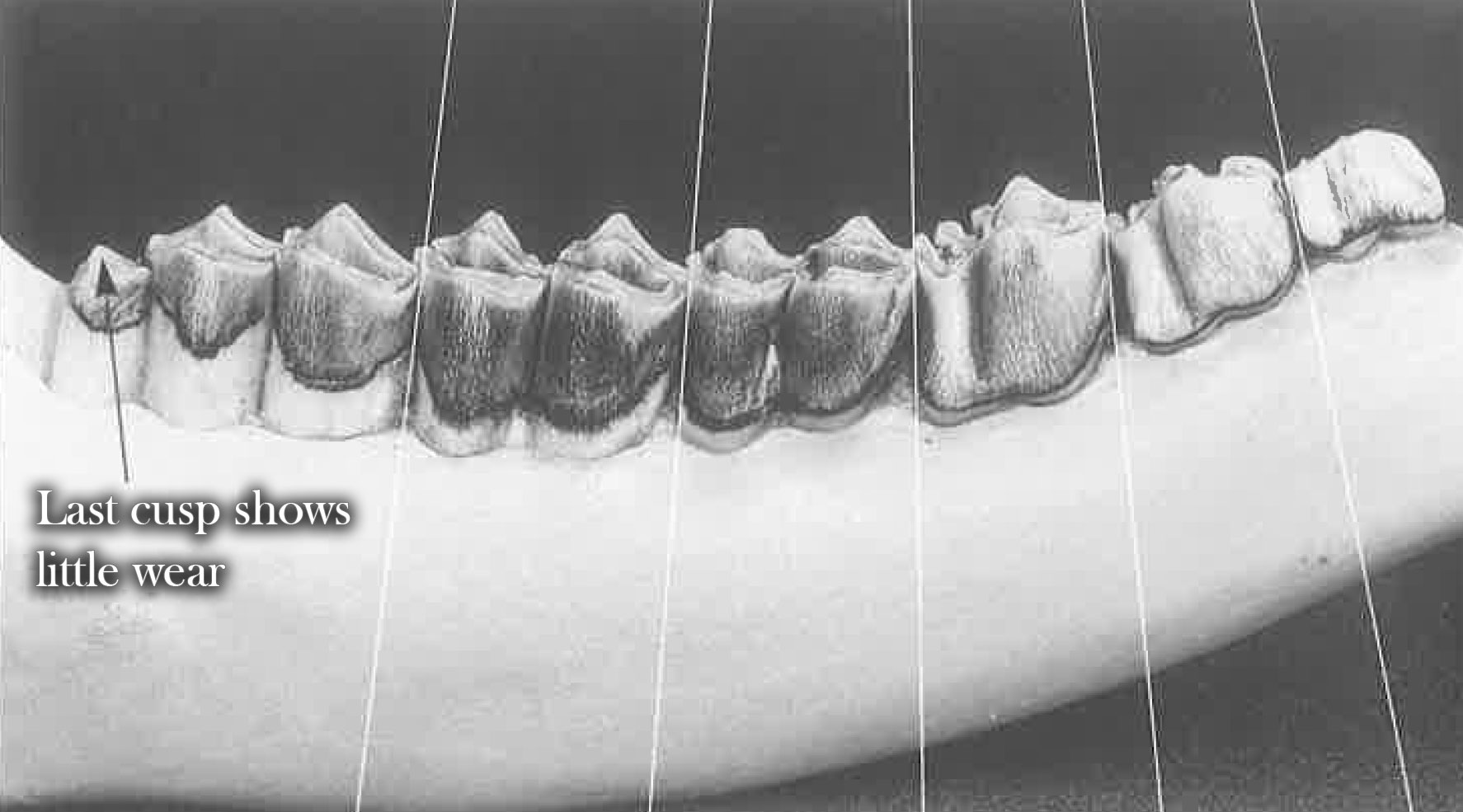 Teeth at 3.5 years of age