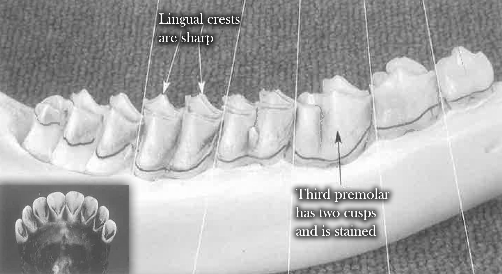 Teeth at 2.5 years of age