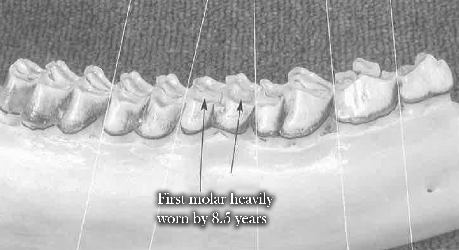 Incisors at 4.5 years of age and older