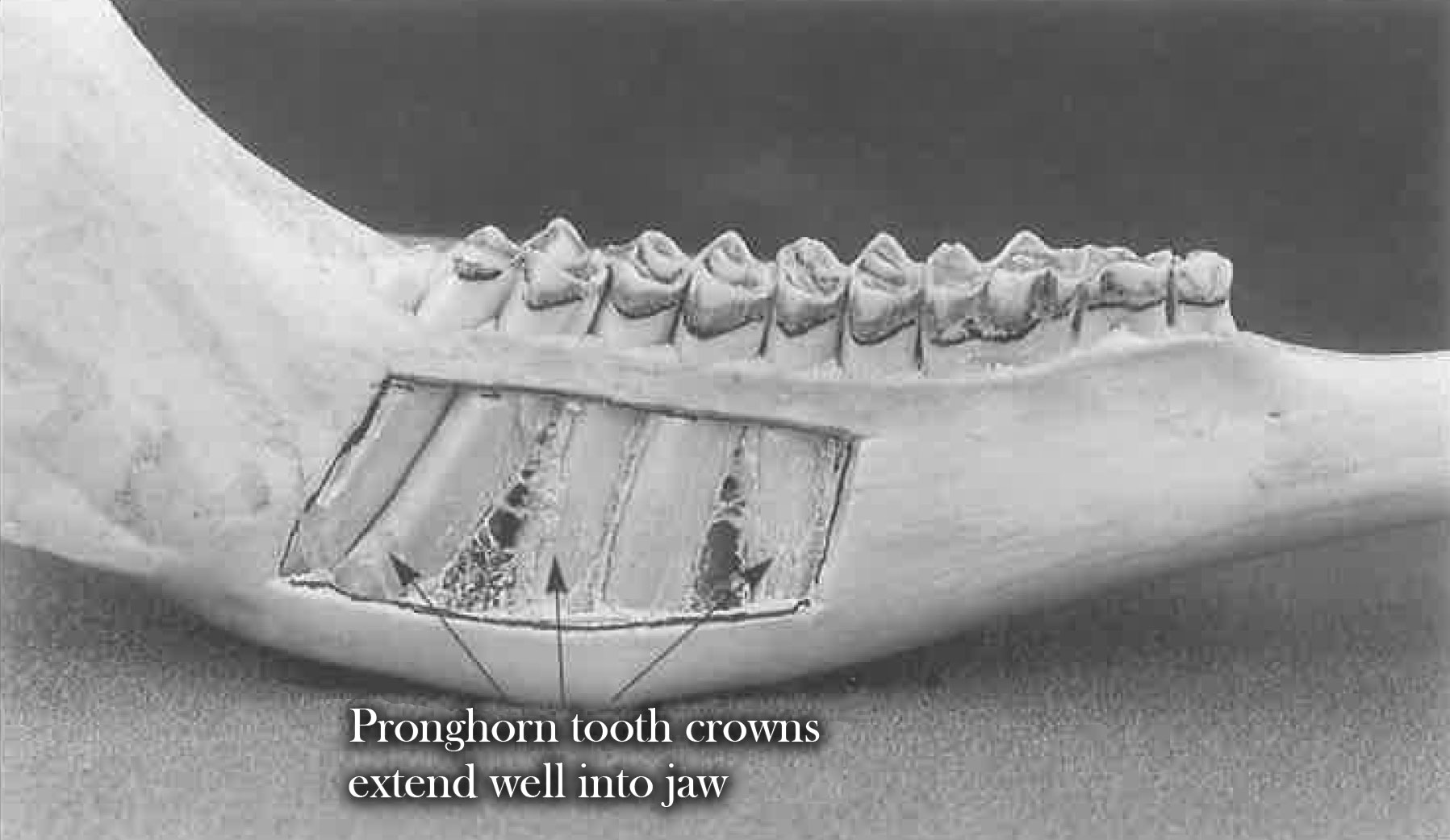 Cutaway of the jaw showing the crowns extending into the jaw