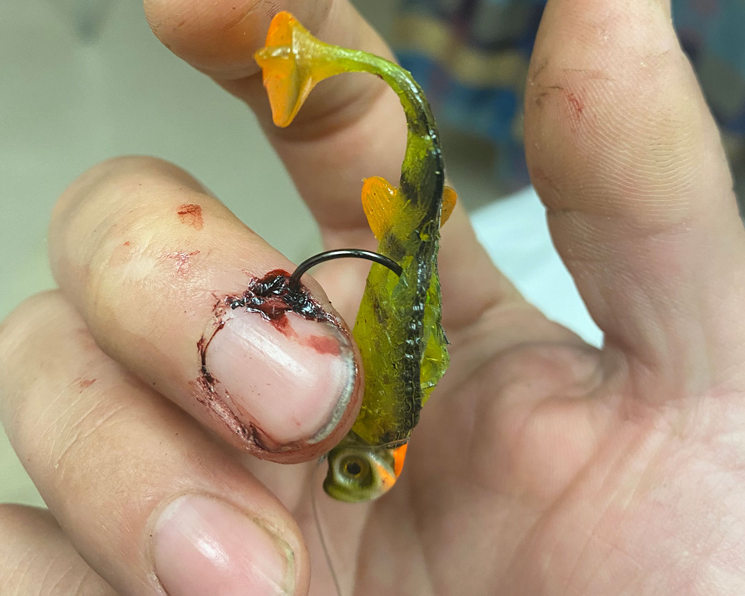 Finger with fish hook caught by nail